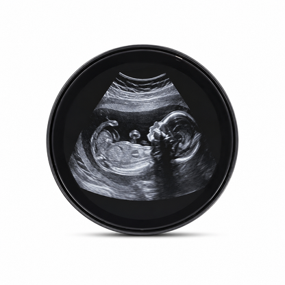 EverFrame™-El primer recuerdo de tu bebe