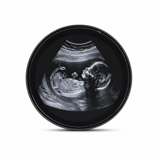 EverFrame™-El primer recuerdo de tu bebe